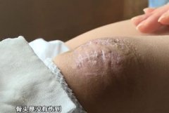 永利注册送34元体验金:广州3岁女童随母亲健身房洗澡，发生令人